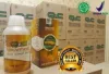 Obat Radang Ginjal (Nefritis) Di Apotik Untuk Anak Dan Dewasa