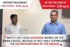 Karma Ayurveda Kidney Patient Name -Mr. Ranveer Singh