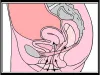 Get sexologist online consultation for Kegel Exercise from best sexologist
