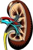  Triggers and Risk Factors for Kidney Stones - All Health Clue 
