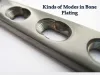  Kinds of Modes in Bone Plating 