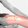 What is The Reasons for knee pain to see a Knee Doctor?