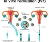 Know Stages of Fertility Treatment - All Information