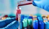 Know the Basics of SGPT Tests with the Best Place to Get It Done