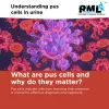 know_all_about_pus_cells_in_urine.png
