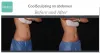 CoolSculpting® Elite in Raleigh, NC and Cary, NC | BodyLase®