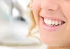 Laser Gingivectomy Treatment Houston | Deep Cleanings Gingivoplasty &amp; Gingivectom