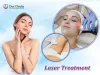 Achieving Flawless Skin With Laser Treatment in Bangalore