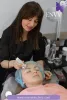 Laser Skin Rejuvenation