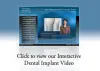 Dental Implants Treatment - Dental Implant Surgeon Mukilteo | HarbourPointe