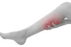 Varicose Vein disorder symptoms and treatment