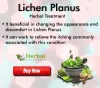 Top 9 Natural Treatments for Lichen Planus - Herbal Care Products