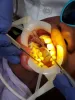 Know Your Options When Looking For An Affordable Orthodontist - good-orthodontist-nearby.over-blog.com