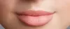  Best Lip Reduction Surgeon in Malviya Nagar, South Delhi.Dr. Hiranmayi Jha