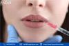 lip_filler_course_london.jpg