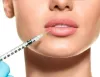 Lip surgery in Hyderabad