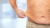 Liposuction surgery in Delhi | Celestia Aesthetica