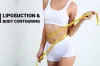 Reshaping Beauty with Liposuction in Chandigarh 