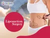 Why Is Liposuction Surgery Done? 