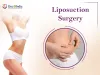 Liposuction Surgery: Reshaping Your Body with Precision
