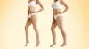 liposuction treatment in Dubai