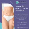 Liposuction Surgery Cost In Chandigarh