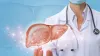        When Is Liver Transplant Needed? - Divya Rathi | Launchora    