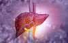 SIGNS AND SYMPTOMS OF LIVER CANCER