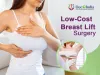 Notable Factors that Affect the Cost of Breast Lift Surgery