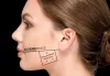 Masseter Botox Jawline Slimming and Bruxism - Precise Dose Injection