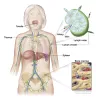 Swollen Lymph Nodes