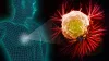 Best Oncologist India - Top Cancer Surgeons in India
