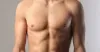 Gynecomastia: All You Need To Know!