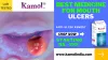 Permanent Cure for mouth ulcer | Best spray for mouth ulcers