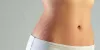 Dengan Cara Menghilangkan Stretch Mark Secara Alami