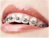 Metal Braces Treatment in Delhi, South Delhi, Greater Kailash