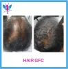 A Revolutionary Hair Growth Factor Treatment For Your Hair