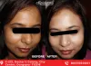 #1 Best Medi Facial Treatments in Durgapur