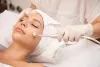 Why the HydraFacial Is One of the Most Popular Treatments