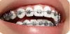 Beat Your Dental Anxiety by Visiting The Best Dental Clinic