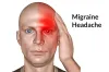 Signs of Migraines