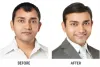 Best Hair Thinning Treatment – RichFeel Anagrow (100% Effective)