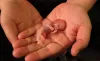 Ayurvedic Treatment for Miscarriage |