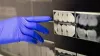 Dentist Teeth Cleaning