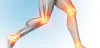 Most Common Orthopedic Implants - Screws, Plates and Prostheses