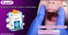 Get Complete Diagnosis For Mouth Cavities | Tooth Decay  