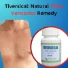 Tiversical: Natural Tinea Versicolor Remedy - Herbal Care Products - Blog