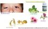 Natural Herbal Treatment for Myasthenia Gravis