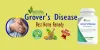 Grovers Disease Natural Treatment