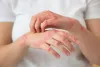 Skin Disorders in Adults